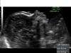Foto de Consultorio de medicina materno fetal-embarazo, control